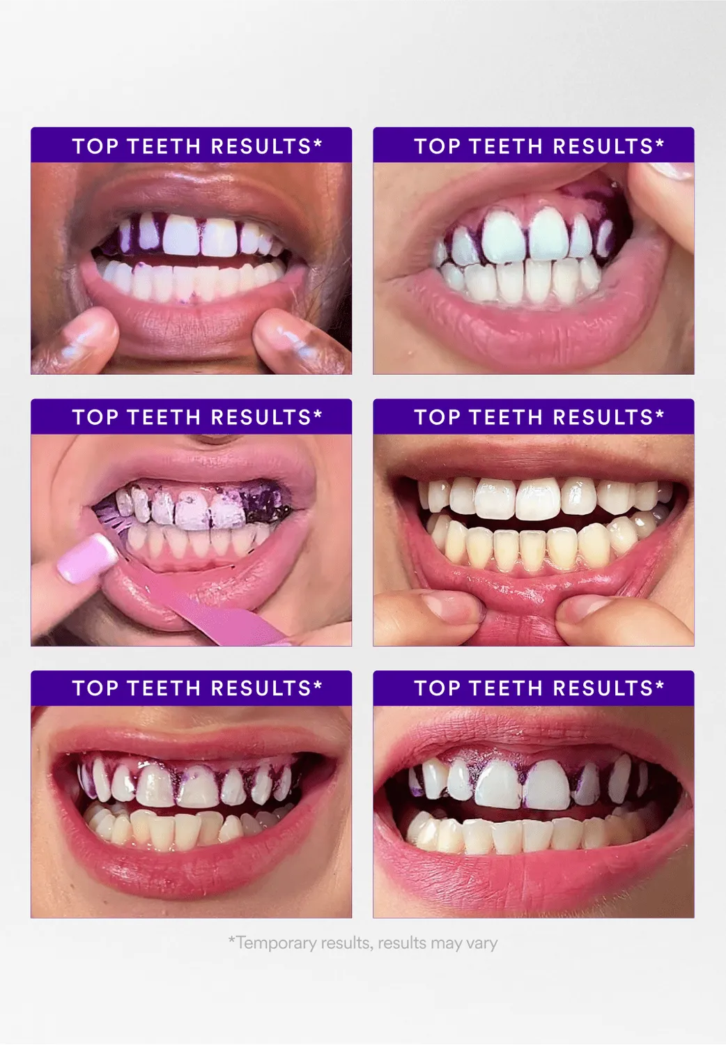 Hismile V34 strisce sbiancanti 14 applicazioni PAP+