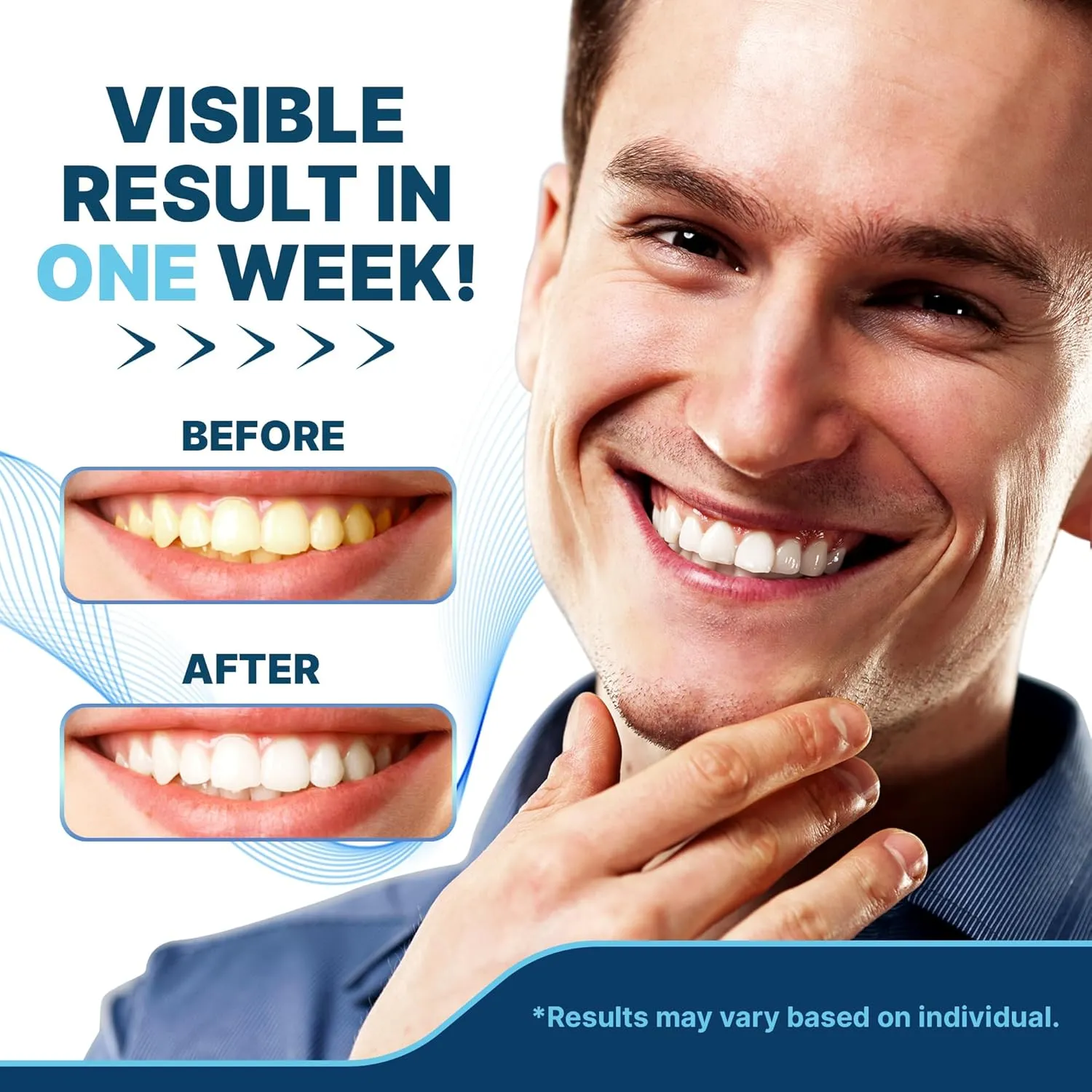 IvorySmile Natural strisce sbiancanti 28 pezzi senza perossido