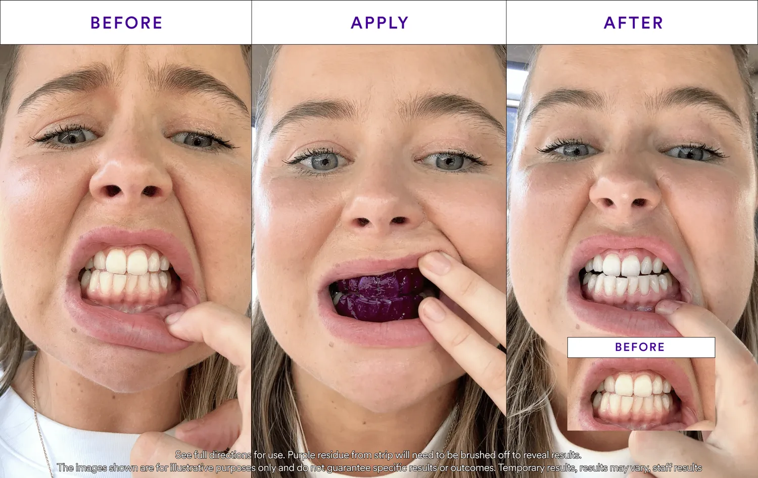 Hismile V34 Strisce Sbiancanti 14 applicazioni PAP+