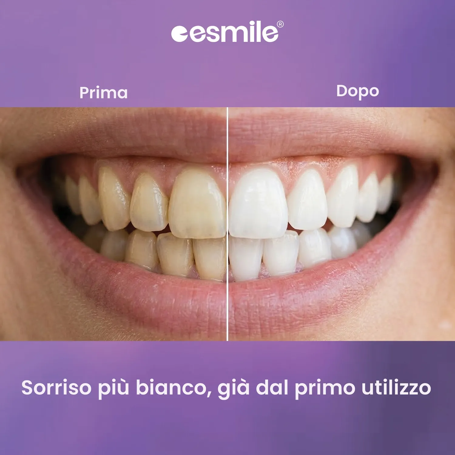 esmile carbone sbiancante viola 30 g senza perossido