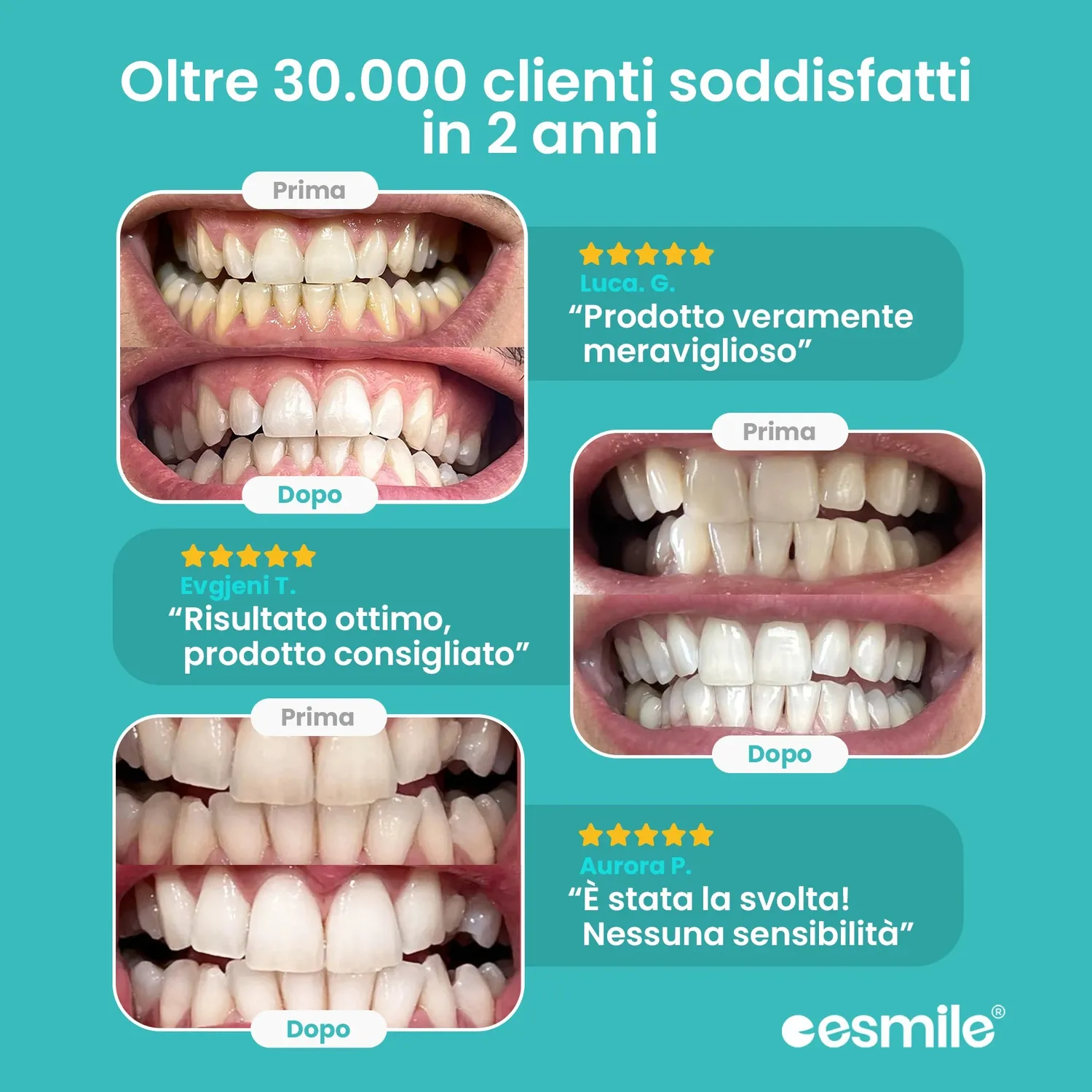 esmile Easy Smile kit sbiancante denti LED senza fili