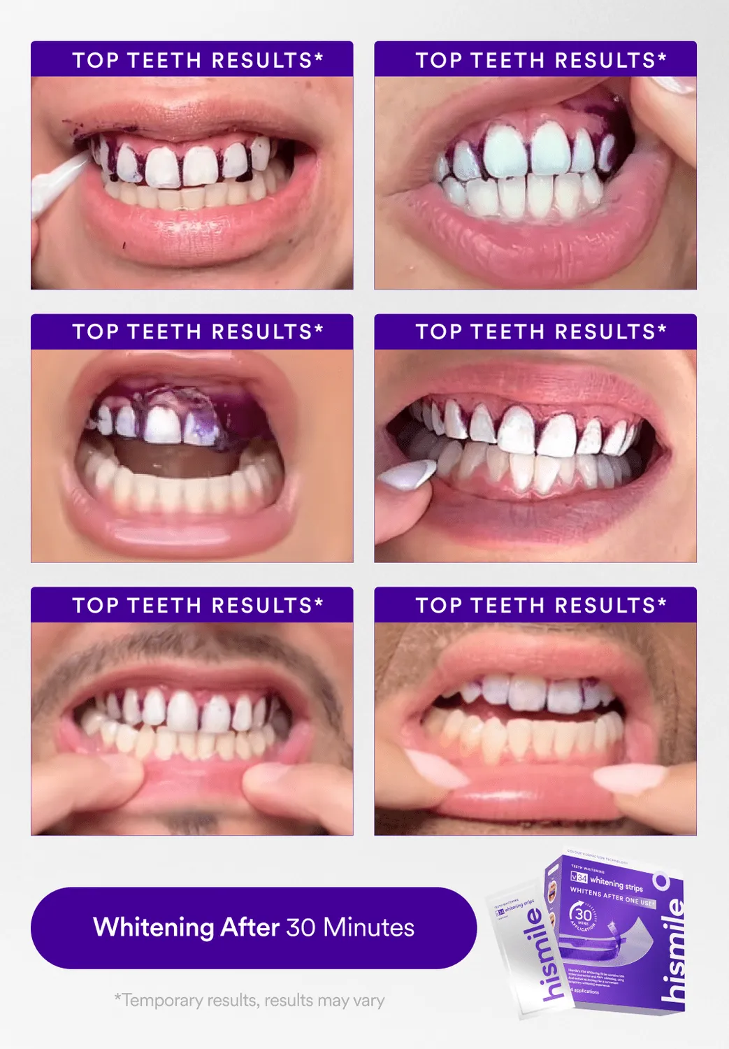 Hismile Affordable Whitening Set kit sbiancante 3 pezzi V34