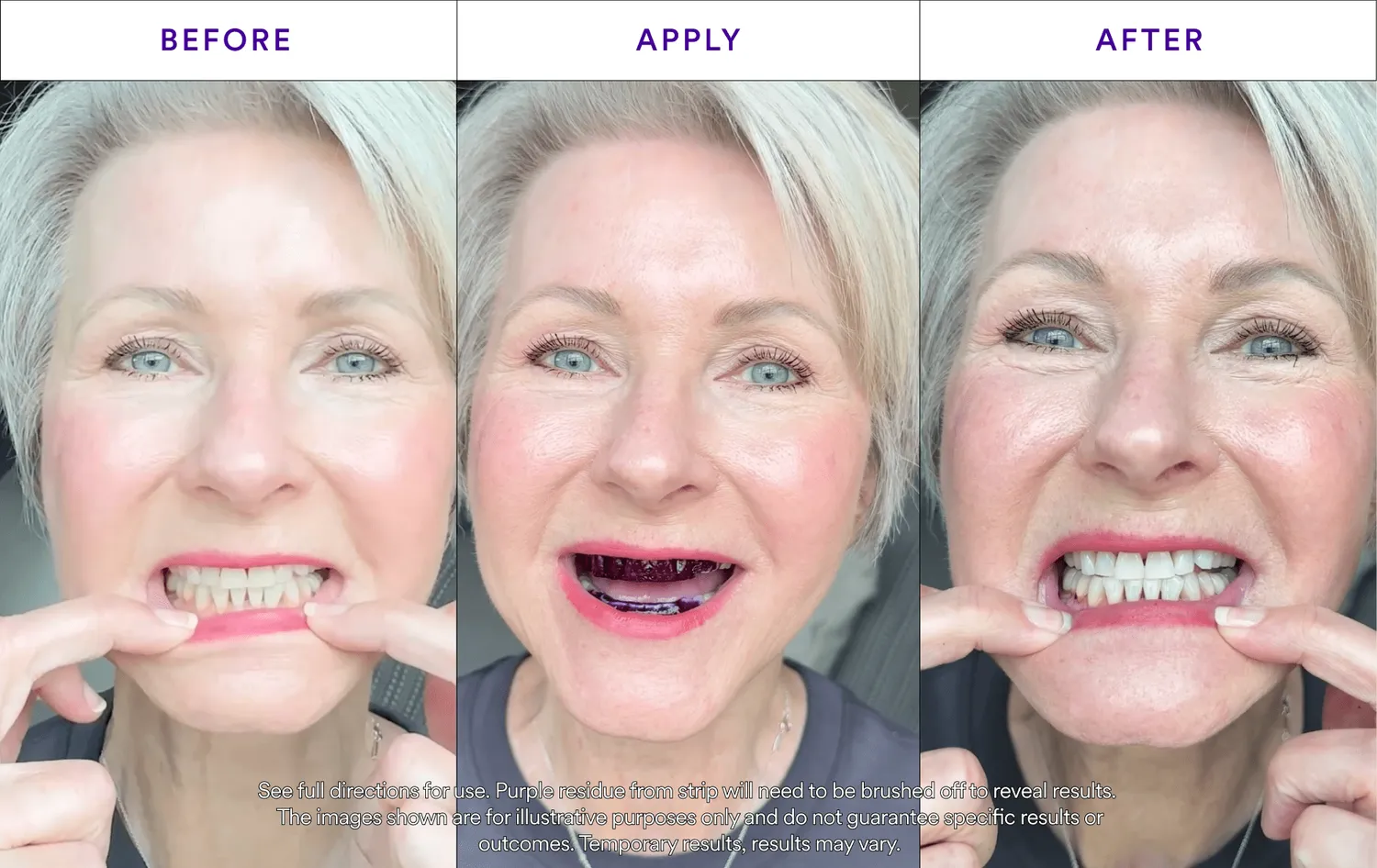 Hismile V34 strisce sbiancanti 14 applicazioni PAP+