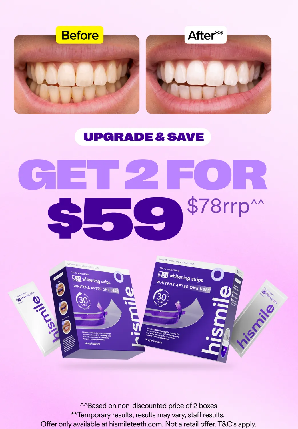 Hismile V34 strisce sbiancanti 28 applicazioni 2 pack PAP+